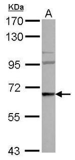 WASF3 Polyclonal Antibody