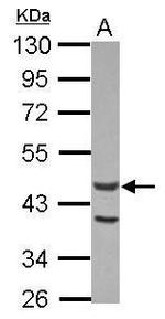 Actin-like 7A Polyclonal Antibody
