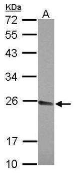 CPSF4 Polyclonal Antibody