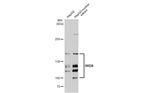 BRD8 Polyclonal Antibody
