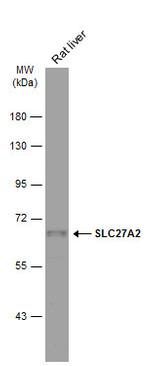 SLC27A2 Antibody in Western Blot (WB)