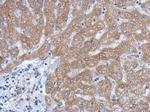 SLC27A2 Antibody in Immunohistochemistry (Paraffin) (IHC (P))