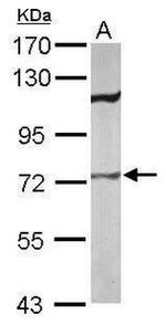 SLC27A2 Antibody in Western Blot (WB)