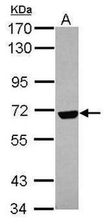SLC27A2 Antibody in Western Blot (WB)