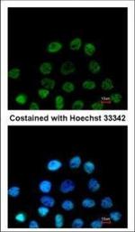 RbAp48 Polyclonal Antibody