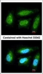 DUSP10 Polyclonal Antibody