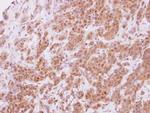 STYXL1 Polyclonal Antibody