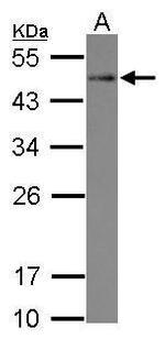 STYXL1 Antibody in Western Blot (WB)