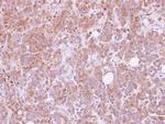 ANKHD1 Polyclonal Antibody