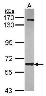 ANKHD1 Antibody in Western Blot (WB)