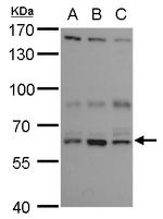 ANKHD1 Antibody in Western Blot (WB)