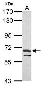 ATE1 Antibody in Western Blot (WB)
