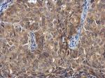FGFR1OP Polyclonal Antibody