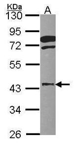 FGFR1OP Antibody in Western Blot (WB)
