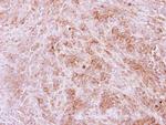 Calpain 11 Antibody in Immunohistochemistry (Paraffin) (IHC (P))