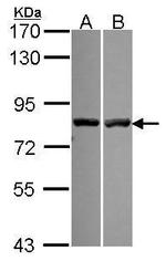 Calpain 11 Antibody in Western Blot (WB)