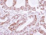 LDB3 Polyclonal Antibody