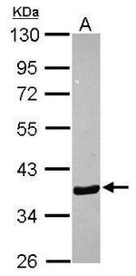 Annexin A10 Antibody in Western Blot (WB)