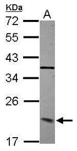 Dynactin 3 Polyclonal Antibody