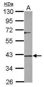 DUSP12 Polyclonal Antibody