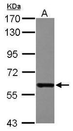 DDX19B Antibody in Western Blot (WB)