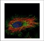 KLHL2 Polyclonal Antibody