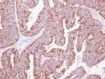 KLHL2 Antibody in Immunohistochemistry (Paraffin) (IHC (P))