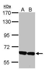 KLHL2 Antibody in Western Blot (WB)