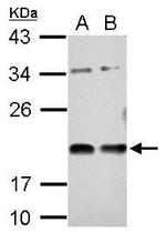VASH1 Polyclonal Antibody