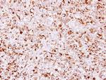 CHSY1 Antibody in Immunohistochemistry (Paraffin) (IHC (P))