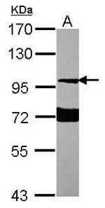 Neuroligin 1 Polyclonal Antibody