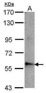 ABLIM3 Polyclonal Antibody