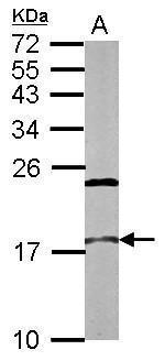 NCBP2 Polyclonal Antibody