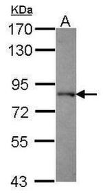 KAP3 Antibody in Western Blot (WB)