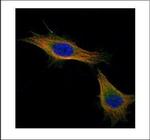 TPX2 Polyclonal Antibody