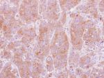 NT5C2 Polyclonal Antibody