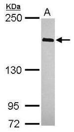 WAPL Polyclonal Antibody