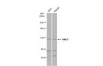 SMC5 Polyclonal Antibody