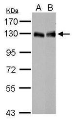 LPIN1 Polyclonal Antibody