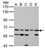 ACSL6 Polyclonal Antibody