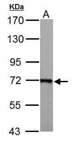 ACSL6 Antibody in Western Blot (WB)