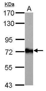 ACSL6 Antibody in Western Blot (WB)