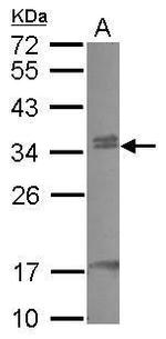 CBX7 Polyclonal Antibody