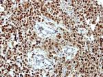 ORC3 Antibody in Immunohistochemistry (Paraffin) (IHC (P))