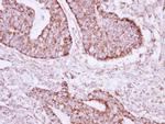 ACOT9 Antibody in Immunohistochemistry (Paraffin) (IHC (P))