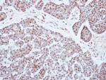 PATZ1 Antibody in Immunohistochemistry (Paraffin) (IHC (P))