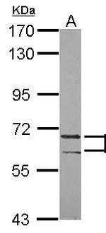 PATZ1 Antibody in Western Blot (WB)
