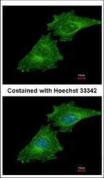 Coronin 3 Polyclonal Antibody
