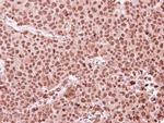 MKRN1 Antibody in Immunohistochemistry (Paraffin) (IHC (P))