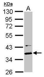 MKRN1 Antibody in Western Blot (WB)